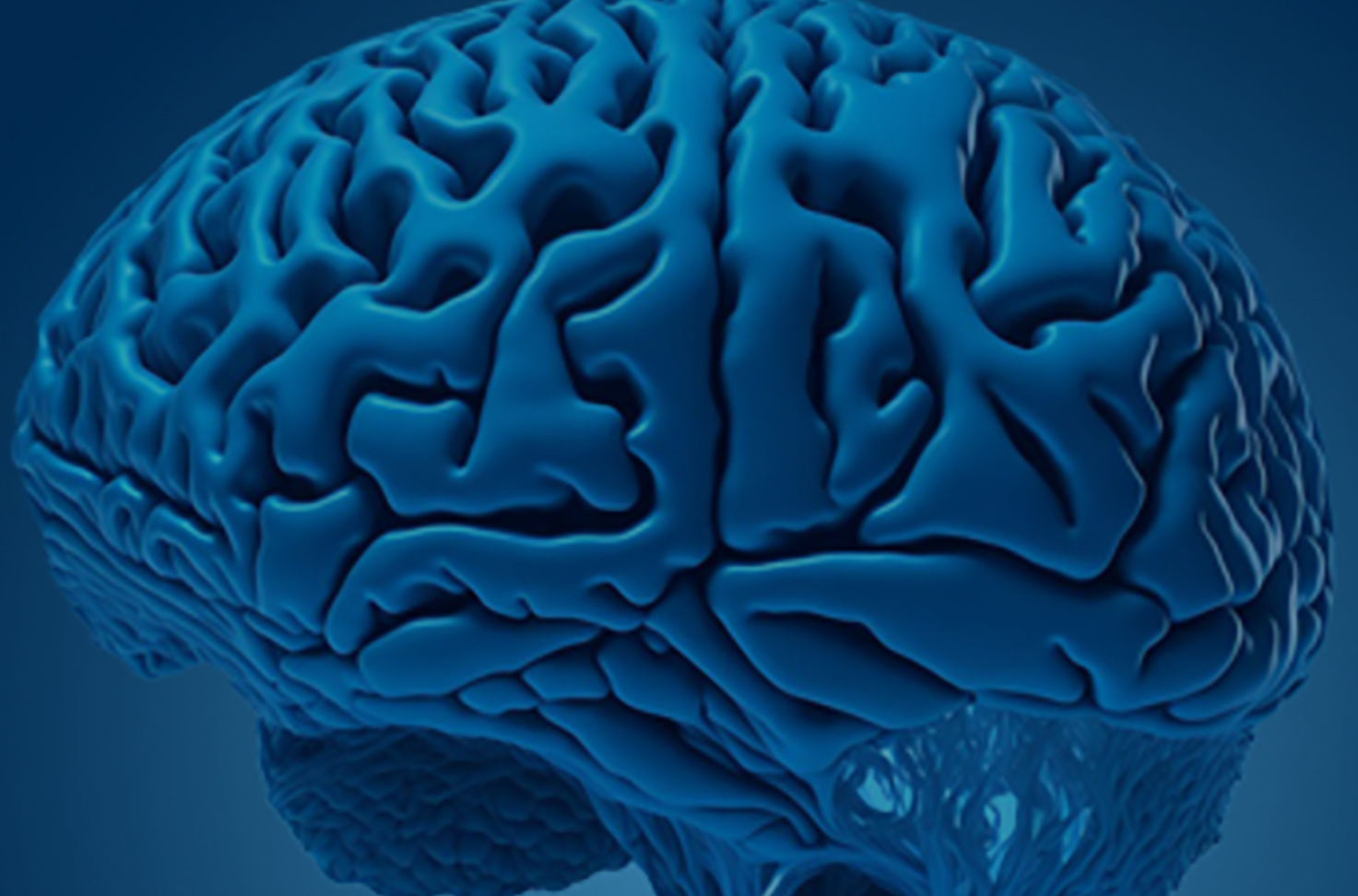 卒中微循環重建